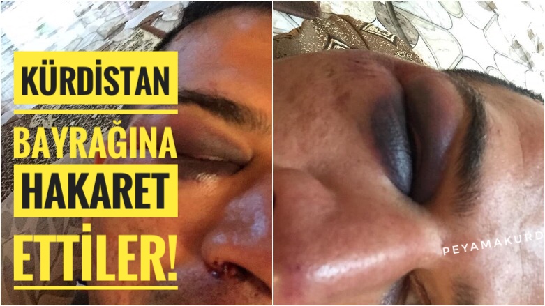 Irak güçleri, Pesmergelere agir iskence yapti!