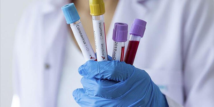 Li Necef a Iraqê bi xwendekarekî Îranî re vîrusa korona derket