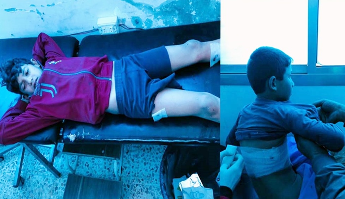 Rojava | Di topbarana ser Eyn Îsayê de du zarok birîndar bûn