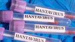 Türkiye Sağlık Bakanlığı'ndan hantavirüs açıklaması