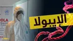 الفرق بين أعراض إيبولا والانفلونزا العادية